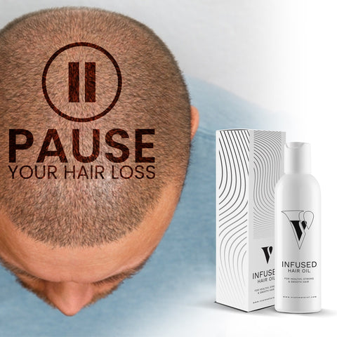 VCARE Natural Infused Hair Oil